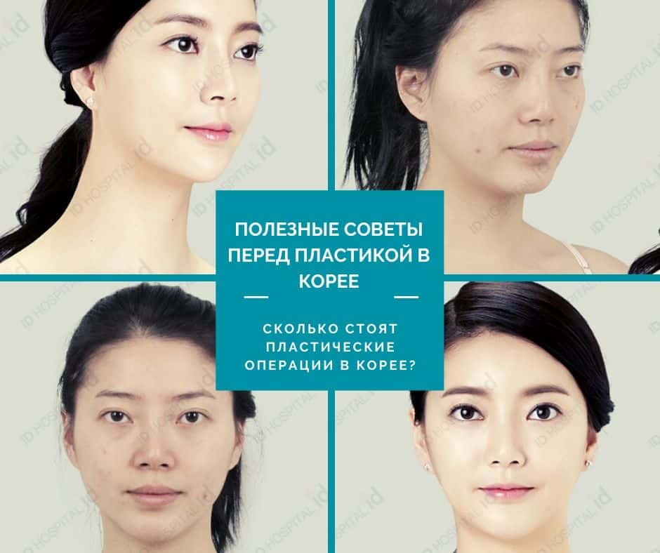 ПОЛЕЗНЫЕ СОВЕТЫ ПЕРЕД ПЛАСТИКОЙ В КОРЕЕ