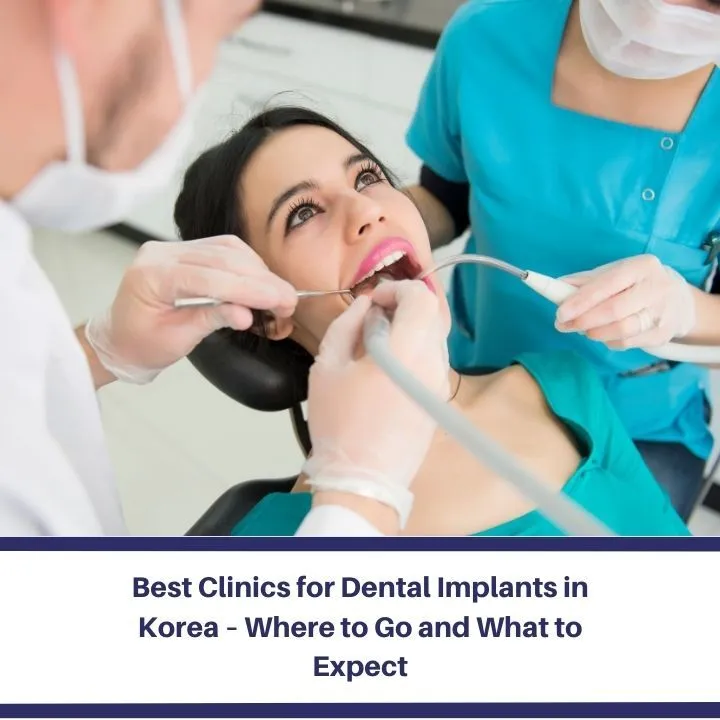 Best Clinics for Dental Implants in Korea – Where to Go and What to Expect